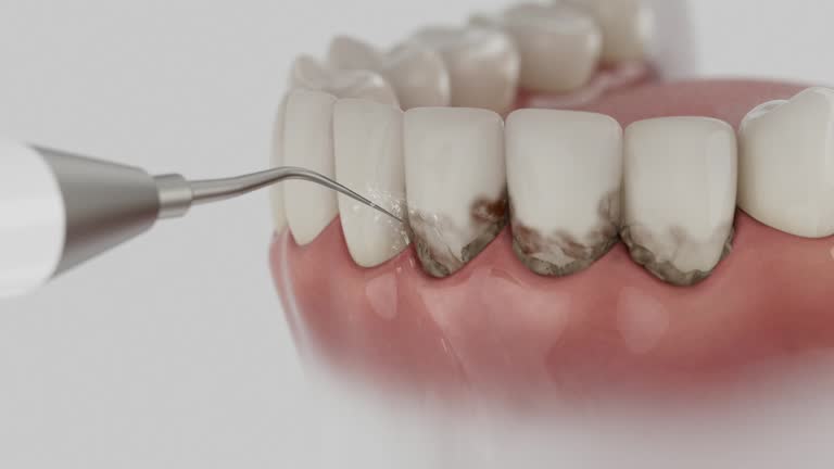 Reliable Teeth Cleaning And Checkup contractor in Monroe County County, MS by Dentist Open Now